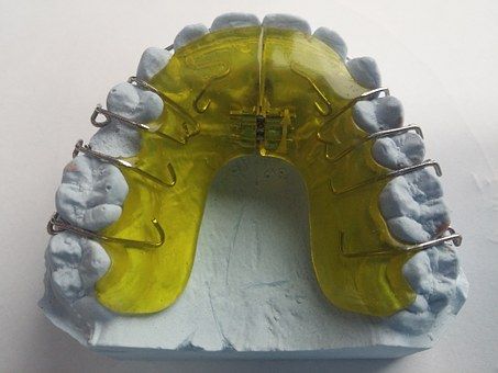 dental-braces-542262__340